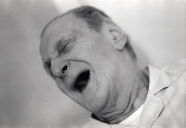 René 1988